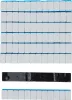 BGS technic Keréksúly 12x5 g, 50 db (BGS 8426)